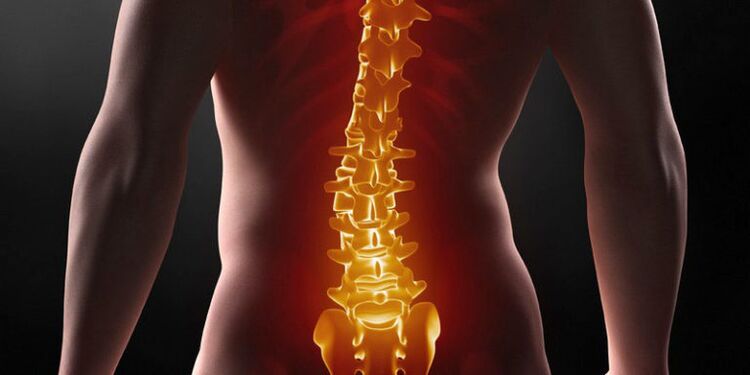 Мъчителна болка в долната част на гърба - симптом на III стадий на лумбална остеохондроза